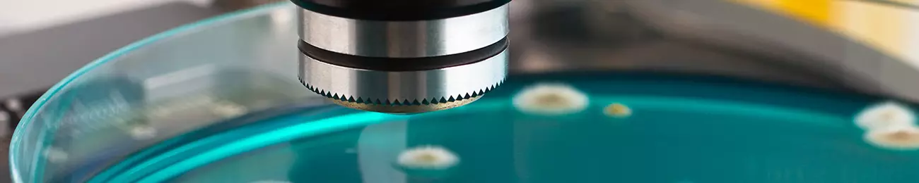 Beitragsbild_Was-ist-Schimmel